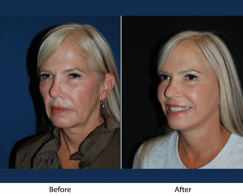 Only Faces Template - 2024-10-13T140949.437